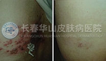 患者治疗前后进行对比