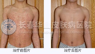 治疗案例对比